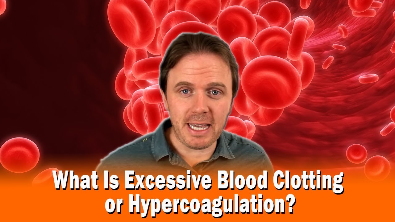 What Is Excessive Blood Clotting or Hypercoagulation? - YouTube