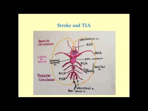 Stroke and TIA - CRASH! Medical Review Series