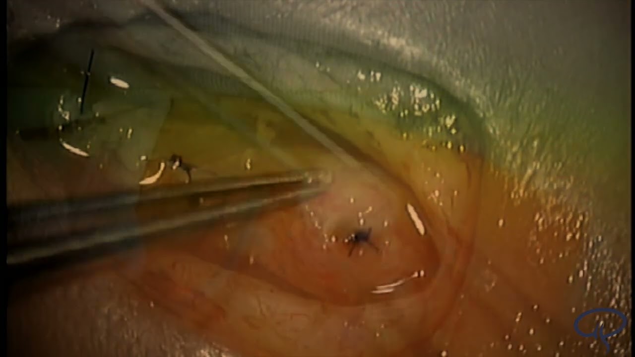 Aurelio Ponce Ayala-16