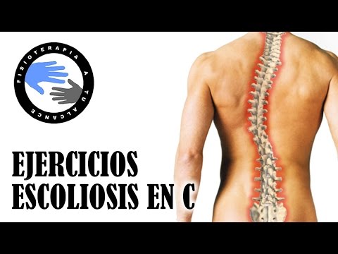 Ejercicios Para Mejorar La Escoliosis Vertebral