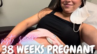 38 WEEKS PREGNANT🤰🏽first & last nst before c-section!