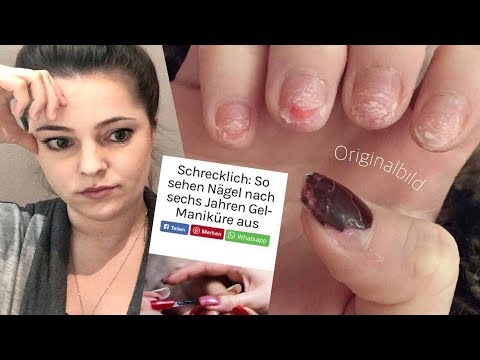 Was bei gribke auf den Nägeln hilft Eksoderil die Salbe, in saratowe zu kaufen