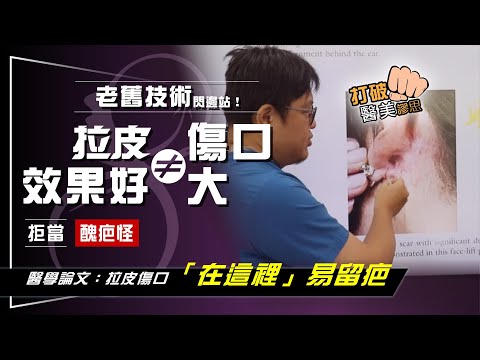 拉皮傷口大不等於效果好 老舊技術是該淘汰了! 解剖學大師解惑:「少做這一步」拉皮效果不持久、易留醜疤痕