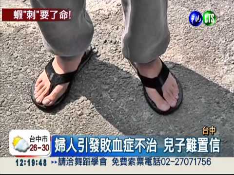 活蝦刺傷小腿 婦染菌截肢不治