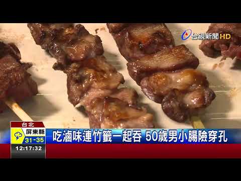 吃滷味連竹籤一起吞 50歲男小腸險穿孔