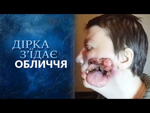 Задачи про остеохондроз Баклофен при остеохондрозе