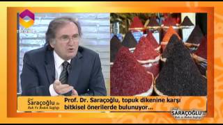 Topuk Dikeni İçin Öneriler - TRT DİYANET