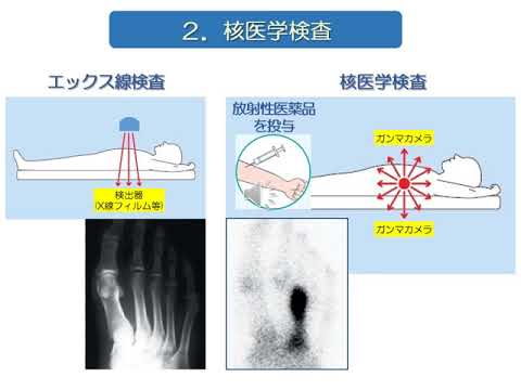 保健学科放射線技術科学専攻概要説明