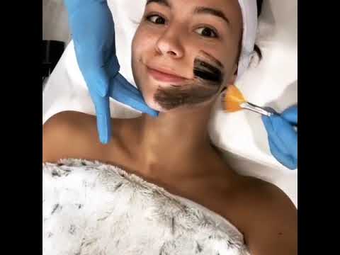 One or Three 60-Minute Carbon Facials at Ultra Cosmetic Clinic (Up to 69% Off) - Second Medium