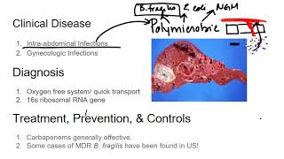 Gram Negative Rods  Bacteroidies fragilis