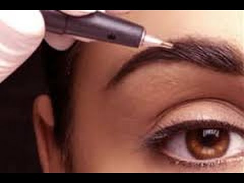 Leliminazione di cosmetici di pigmentary nota su una faccia La pigmentazione di postacne di pelle come liberarsi