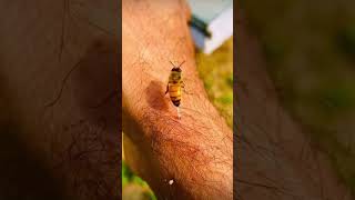 Bee sting #shorts #bee #sting