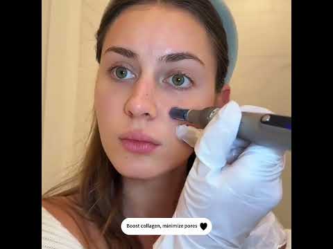 Dr. Pen A8S/M8S/A6S microneedling pen—professional-grade skin renewal at home!