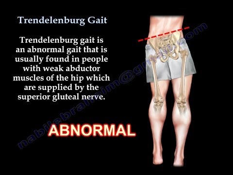Beseitigung von Bandscheibenbruch Belarusian Salbe für Gelenke
