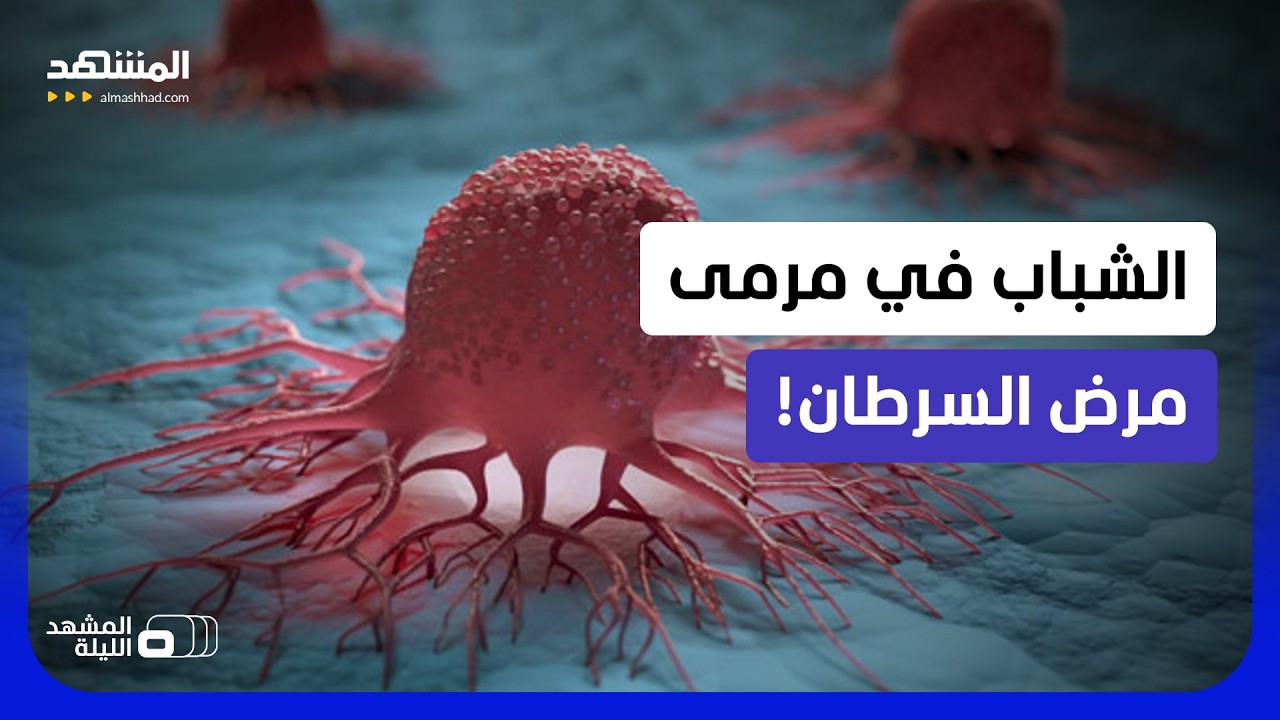 السرطان يضرب الشباب مبكرا.. ما أسباب تزايد الإصابات في سن أصغر؟  - المشهد اللي?