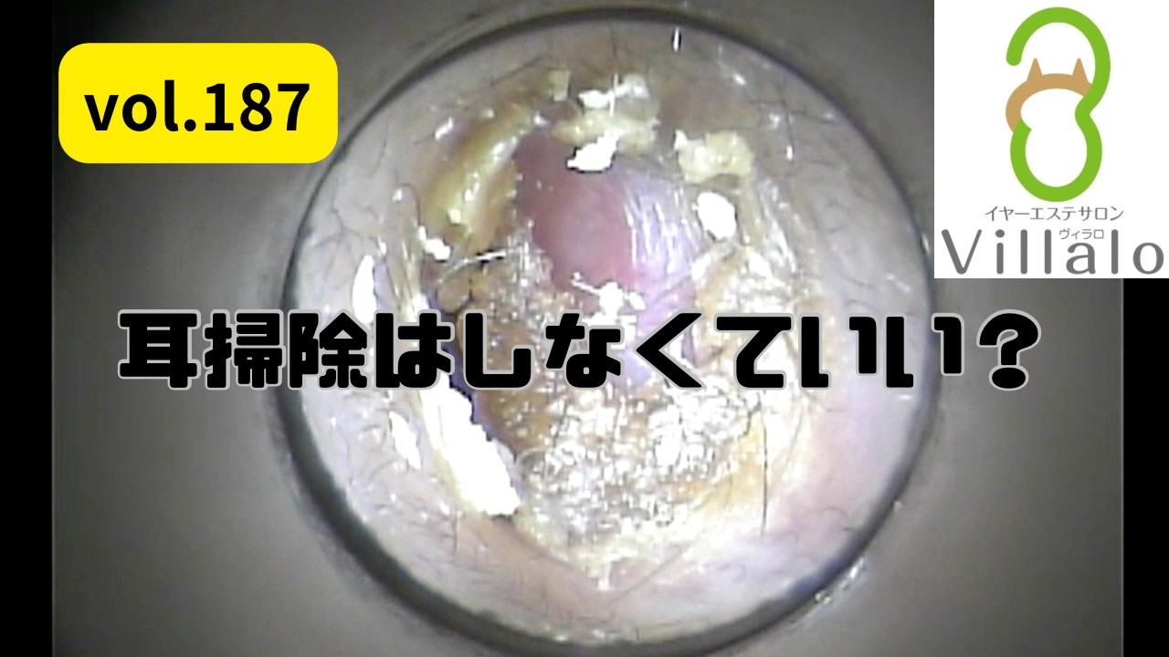 耳掃除 vol.187「耳掃除はしなくていいと聞いていたのに…」(ear wax removal)イヤーエステサロンVillalo～ヴィラロ～