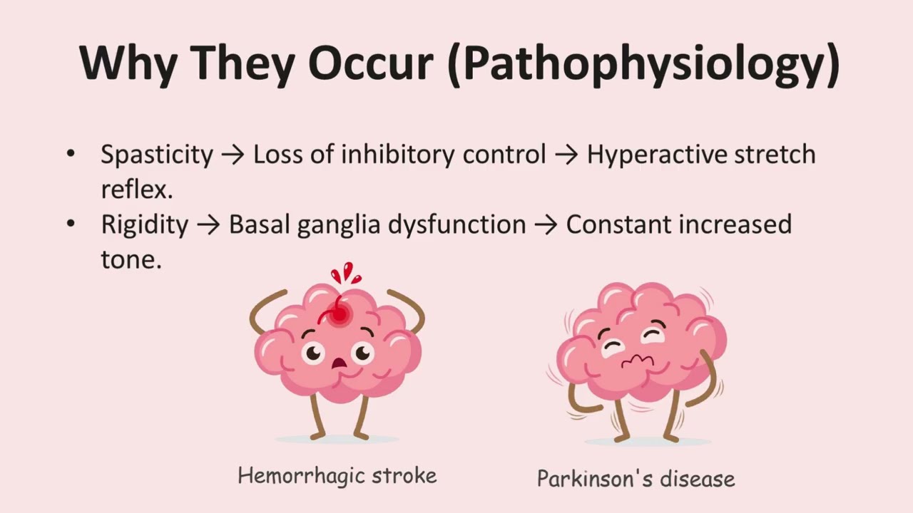 Spasticity vs Rigidity | Easy to Understand