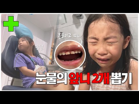 충격과 눈물의 연속 앞니뽑기 (+산리오 랜덤키링)