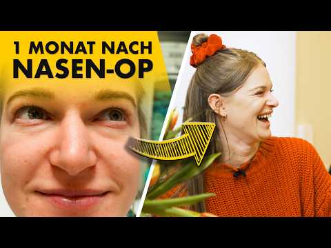 "Sie sieht aus wie ein Model!" | Nasen-OP Vorher Nachher