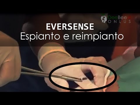Come fare un trucco se le lentiggini di persona Decolorazione di pigmentazione della pelle di mezzi