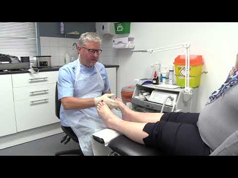 Watch a diabetic foot check
