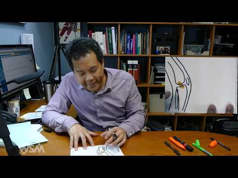 Illustrated summary of ACL knee anatomy and biomechanics of ACL injuries