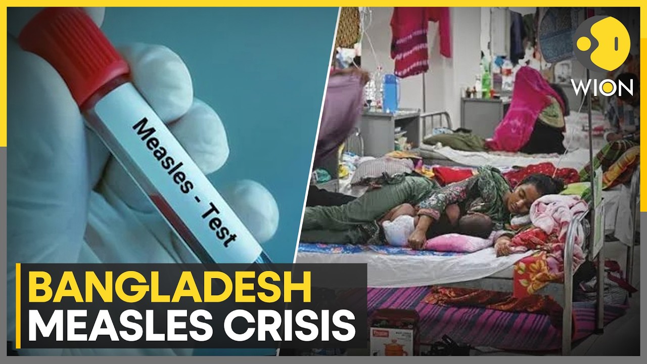 Bangladesh Measles Outbreak Turns Deadly | Child Deaths Near 1,000 as Cases Cross 180,000