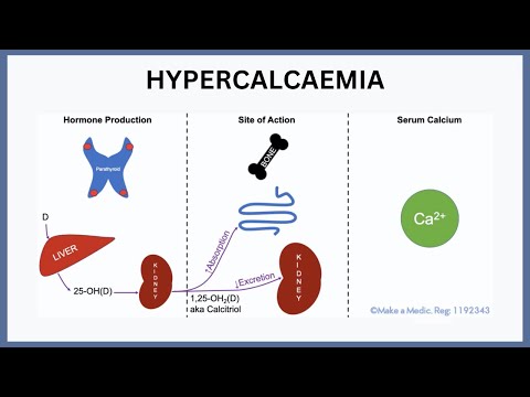 Hypercalcaemia Explained