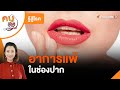 อาการ