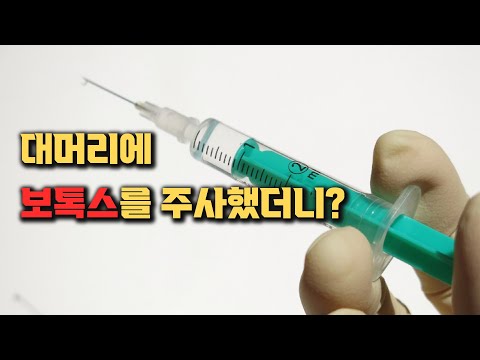 탈모치료에 이용 되는 보톡스의 효과