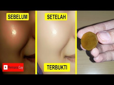 download lagu mp3 mp4 Tips Wajah Hitam Menjadi Putih, download lagu Tips Wajah Hitam Menjadi Putih gratis, unduh video klip Tips Wajah Hitam Menjadi Putih