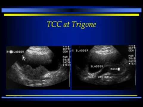 GU Sonography of the Urinary Bladder, Scrotum & Prostate