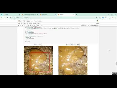 Chicken Disease Prediction in Python Projects