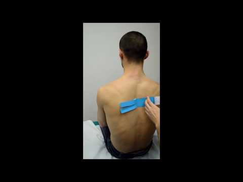 Dolore alla pressione nel collo al pomo dAdamo Protesi danca in recensioni Izhevsk