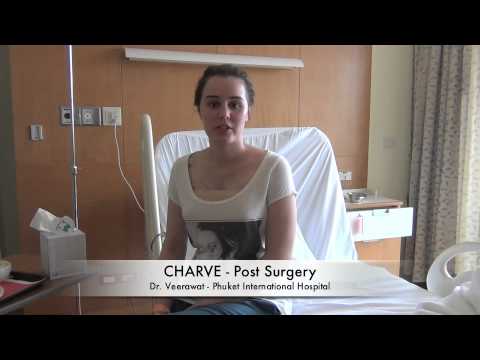 Fran & Charve's Breast Augmentation Diary with Restored Beauty Getaways