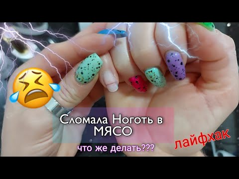 Сломала ноготь в Мясо 😰