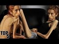 Top 5 Skinniest People In The World