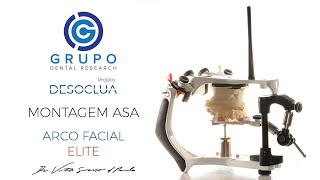 Montagem do modelo superior no articulador ASA A7Plus com o Arco Facial ELITE - Projeto DESOCLUA