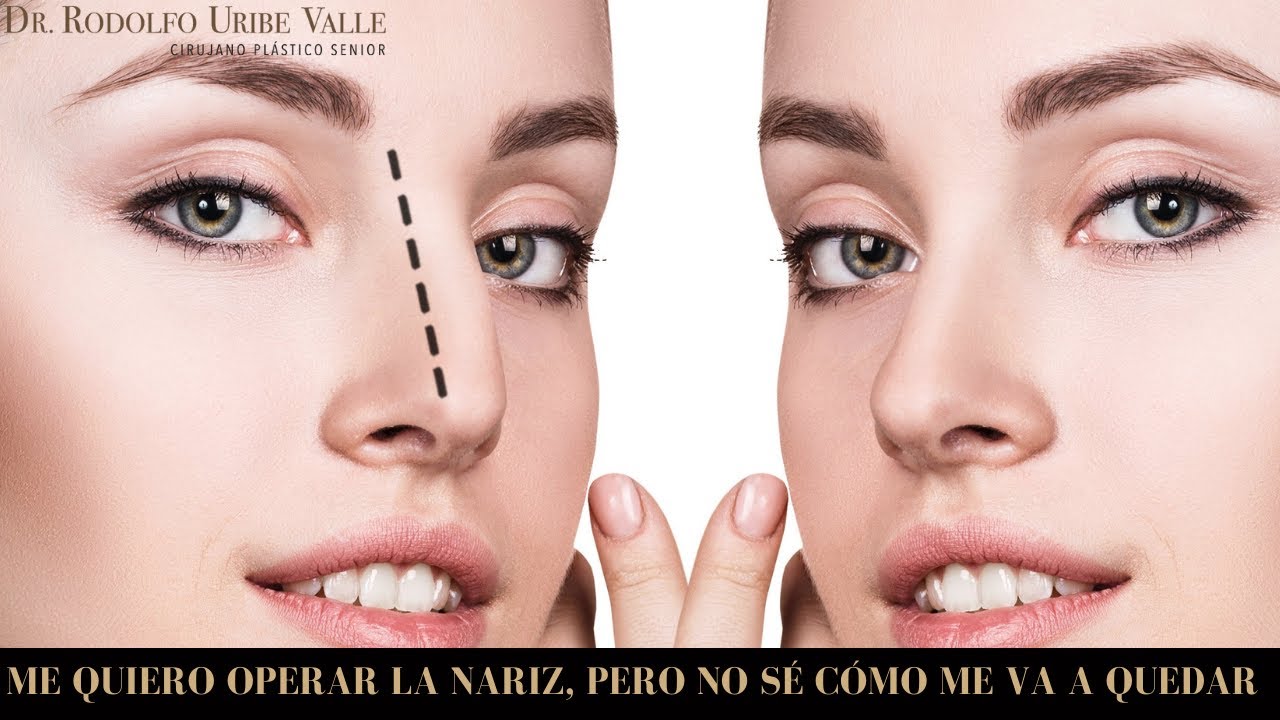 Watch Me quiero operar la nariz, pero no sé cómo me va a quedar Now Me quiero operar la nariz, pero no sé cómo me va a quedar