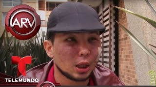 Joven quería ser más guapo y terminó desfigurado | Al Rojo Vivo | Telemundo