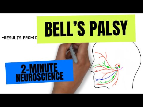 2-Minute Neuroscience: Bell's Palsy