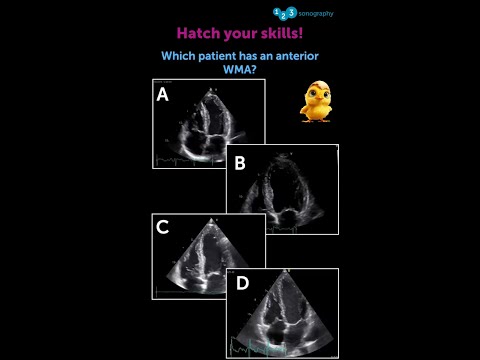 Are you an expert in assessing wall motion abnormalities?