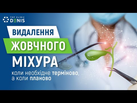 Холецистэктомия: когда необходима срочно, а когда планово - TOP Clinic DENIS