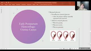 Unit 3a Postpartum Hemorrhage, Infection & Mental Health