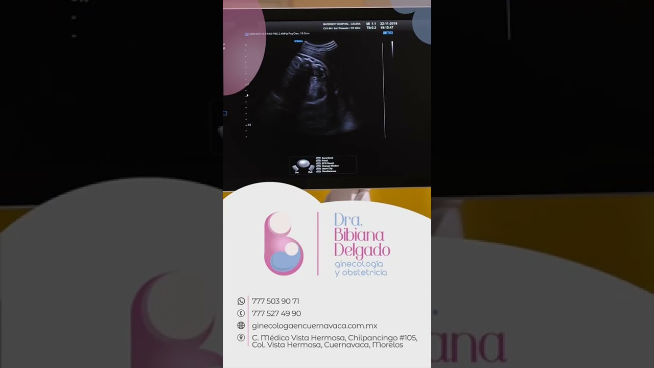 Bibiana Delgado García-23