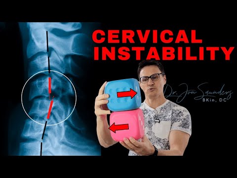Cervical Instability: What You Should Know | Dr. Jon Saunders
