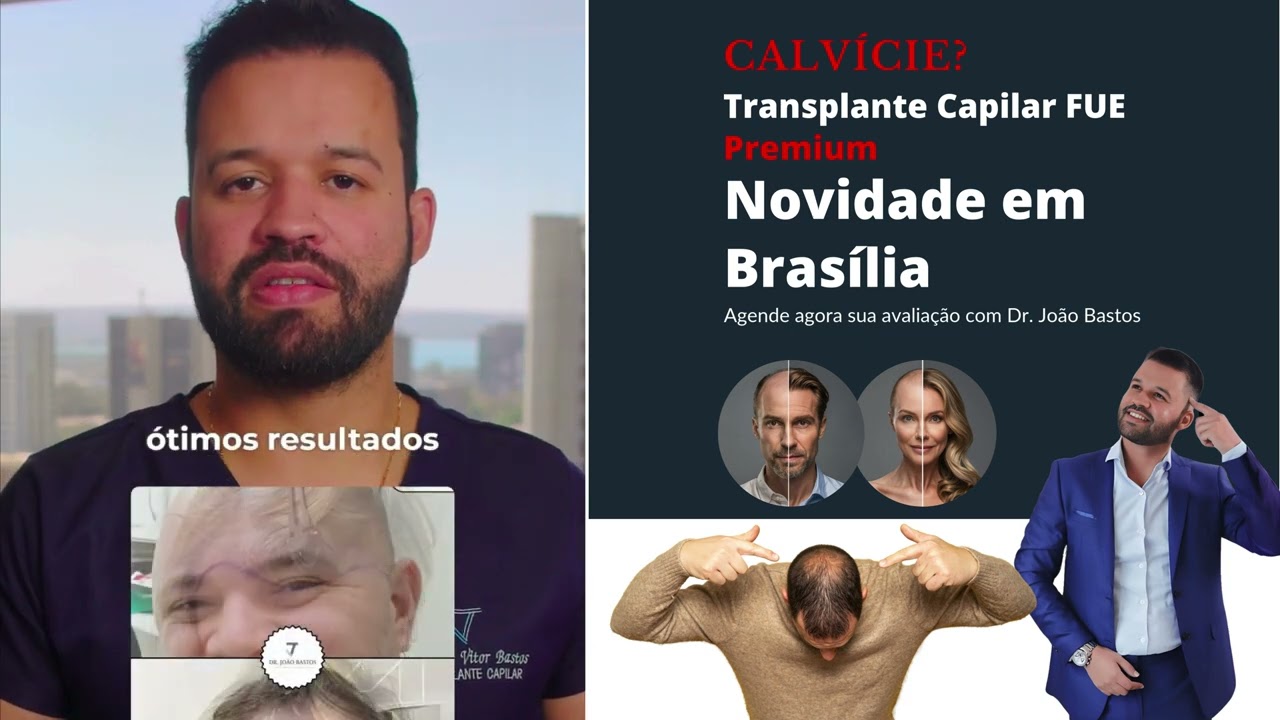 Transplante Capilar: A Solução Definitiva para Calvície e Queda de Cabelo | Dr. Especialista