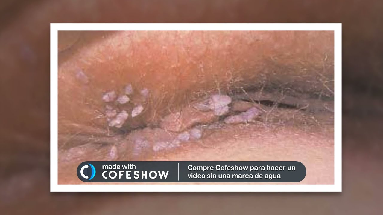 Josué Pérez Sulbarán-13