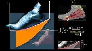 [討論] 彎折與跟腳的關係