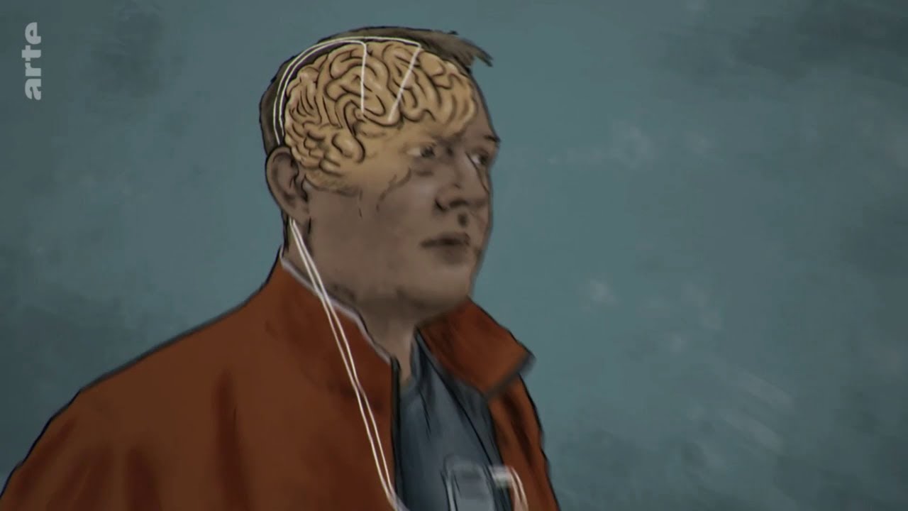 Jetzt Parkinson Forschung Bringt Hoffnung ansehen Parkinson Forschung Bringt Hoffnung